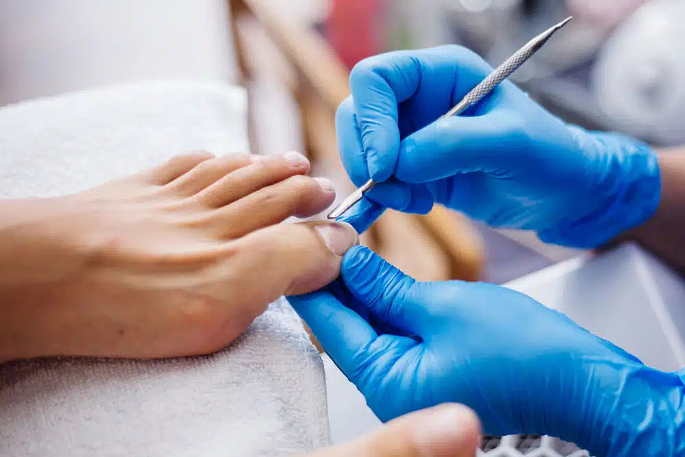 Unveiling the Painful Truth: Conquering Ingrown Toenails