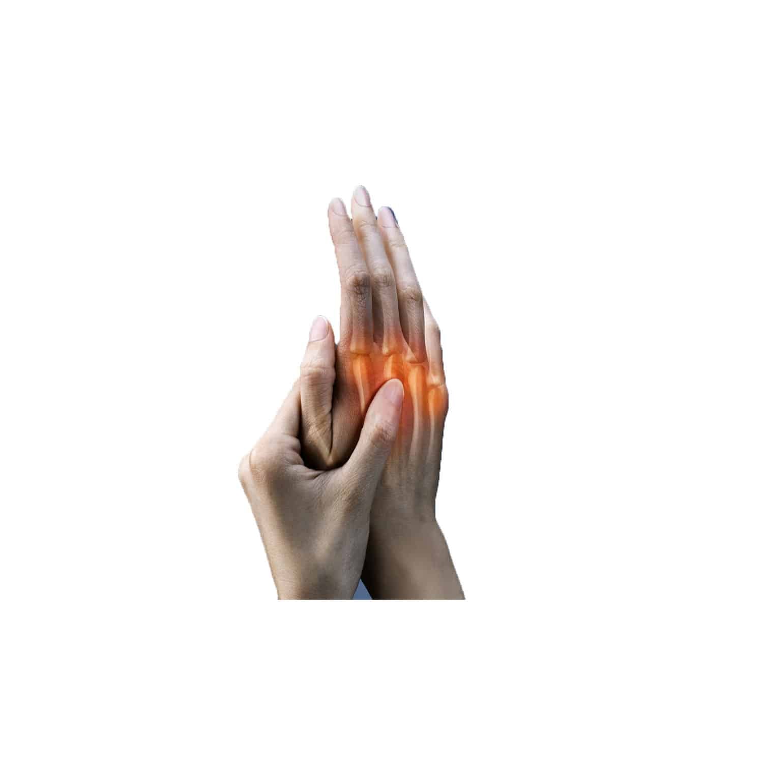 H-Arthritis Formula – Natural Topical Relief for Arthritis Symptoms